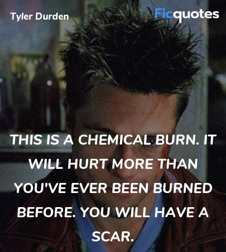 This is a chemical burn. It will hurt more than you've ever been burned before. You will have a scar. image